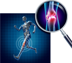 Knee arthrosis